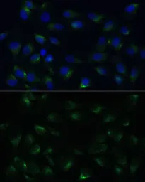 Anti-PGRMC1 antibody used in Immunocytochemistry/ Immunofluorescence (ICC/IF). GTX54607