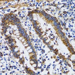 Anti-PGRMC1 antibody used in IHC (Paraffin sections) (IHC-P). GTX54607