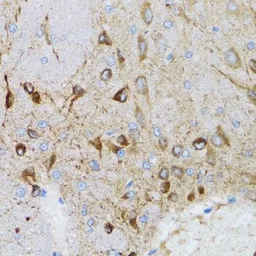 Anti-PGRMC1 antibody used in IHC (Paraffin sections) (IHC-P). GTX54607