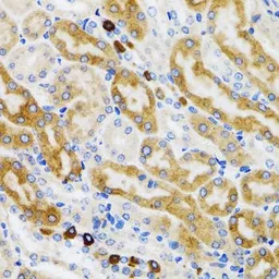 Anti-PGRMC1 antibody used in IHC (Paraffin sections) (IHC-P). GTX54607