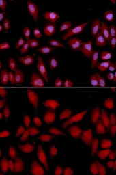 Anti-Proteasome 20S alpha 2 antibody used in Immunocytochemistry/ Immunofluorescence (ICC/IF). GTX54618