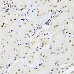 Anti-PTBP1 antibody used in IHC (Paraffin sections) (IHC-P). GTX54619