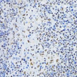 Anti-PTBP1 antibody used in IHC (Paraffin sections) (IHC-P). GTX54619