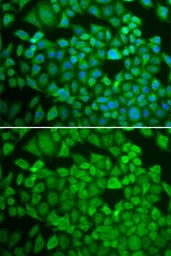 Anti-NR0B1 antibody used in Immunocytochemistry/ Immunofluorescence (ICC/IF). GTX54624