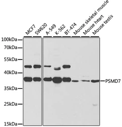 Anti-PSMD7 antibody used in Western Blot (WB). GTX54625