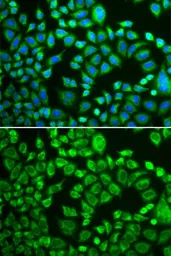 Anti-PSMD7 antibody used in Immunocytochemistry/ Immunofluorescence (ICC/IF). GTX54625
