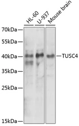 Anti-TUSC4 antibody used in Western Blot (WB). GTX54626