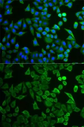 Anti-TUSC4 antibody used in Immunocytochemistry/ Immunofluorescence (ICC/IF). GTX54626