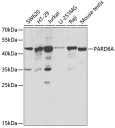 Anti-PARD6A antibody used in Western Blot (WB). GTX54628
