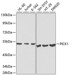 Anti-PICK1 antibody used in Western Blot (WB). GTX54630