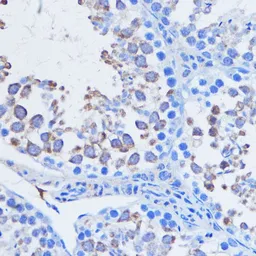 Anti-PIWIL1 antibody used in IHC (Paraffin sections) (IHC-P). GTX54631