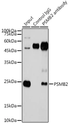 Anti-PSMB2 antibody used in Immunoprecipitation (IP). GTX54633