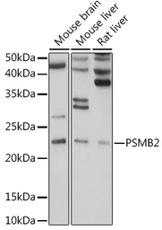 Anti-PSMB2 antibody used in Western Blot (WB). GTX54633