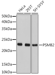Anti-PSMB2 antibody used in Western Blot (WB). GTX54633