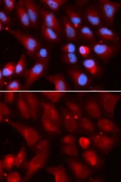 Anti-PSMB2 antibody used in Immunocytochemistry/ Immunofluorescence (ICC/IF). GTX54633