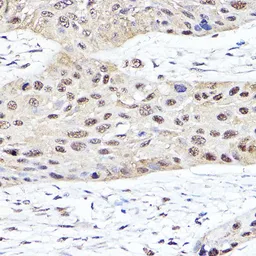 Anti-PSMB2 antibody used in IHC (Paraffin sections) (IHC-P). GTX54633