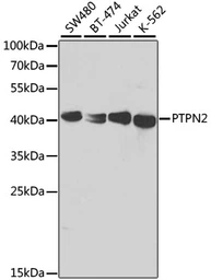 Anti-TCPTP antibody used in Western Blot (WB). GTX54634