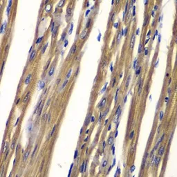 Anti-TCPTP antibody used in IHC (Paraffin sections) (IHC-P). GTX54634