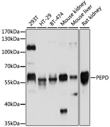 Anti-PEPD antibody used in Western Blot (WB). GTX54636