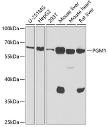 Anti-PGM1 antibody used in Western Blot (WB). GTX54640