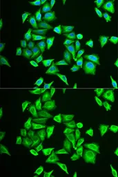 Anti-PGM1 antibody used in Immunocytochemistry/ Immunofluorescence (ICC/IF). GTX54640