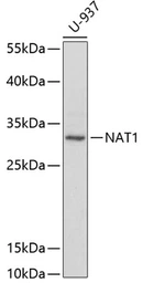 Anti-NAT1 antibody used in Western Blot (WB). GTX54641