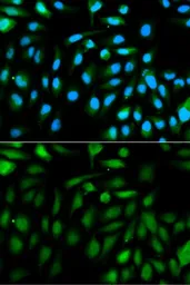 Anti-Park7 / DJ-1 antibody used in Immunocytochemistry/ Immunofluorescence (ICC/IF). GTX54642