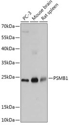 Anti-PSMB1 antibody used in Western Blot (WB). GTX54643