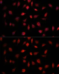 Anti-PSMB1 antibody used in Immunocytochemistry/ Immunofluorescence (ICC/IF). GTX54643
