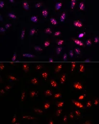 Anti-PSMB1 antibody used in Immunocytochemistry/ Immunofluorescence (ICC/IF). GTX54643