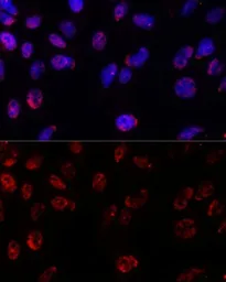 Anti-PSMB1 antibody used in Immunocytochemistry/ Immunofluorescence (ICC/IF). GTX54643