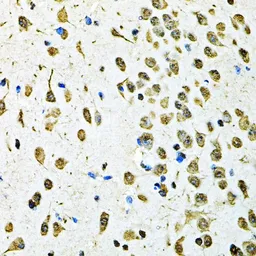 Anti-PSMB1 antibody used in IHC (Paraffin sections) (IHC-P). GTX54643