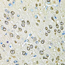 Anti-PSMB1 antibody used in IHC (Paraffin sections) (IHC-P). GTX54643