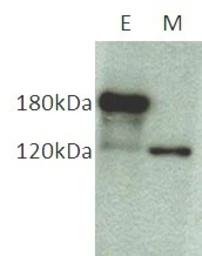 Anti-COL17A1 antibody [NC16a-3] used in Western Blot (WB). GTX54647