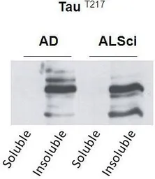 Anti-Tau (phospho Thr217) antibody used in Western Blot (WB). GTX54655