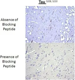 Anti-Tau (phospho Ser208/210) antibody used in Immunohistochemistry (IHC). GTX54656