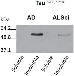 Anti-Tau (phospho Ser208/210) antibody used in Western Blot (WB). GTX54656