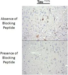 Anti-Tau (phospho Thr175) antibody used in Immunohistochemistry (IHC). GTX54657