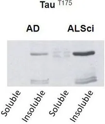 Anti-Tau (phospho Thr175) antibody used in Western Blot (WB). GTX54657