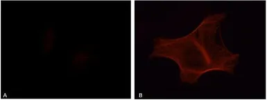 Anti-Tau (phospho Tyr18) antibody [9G3] used in Immunocytochemistry/ Immunofluorescence (ICC/IF). GTX54658