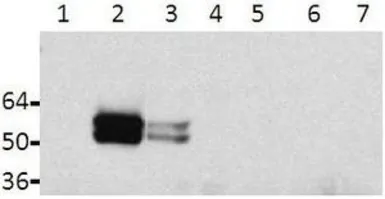 Anti-Tau (phospho Tyr18) antibody [9G3] used in Western Blot (WB). GTX54658