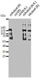Anti-Robo4 antibody used in Western Blot (WB). GTX54660