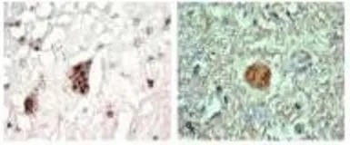 Anti-RGNEF antibody used in IHC (Paraffin sections) (IHC-P). GTX54661