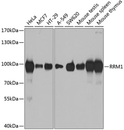Anti-RRM1 antibody used in Western Blot (WB). GTX54666