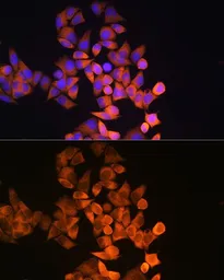 Anti-RRM1 antibody used in Immunocytochemistry/ Immunofluorescence (ICC/IF). GTX54666