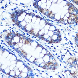 Anti-RRM1 antibody used in IHC (Paraffin sections) (IHC-P). GTX54666