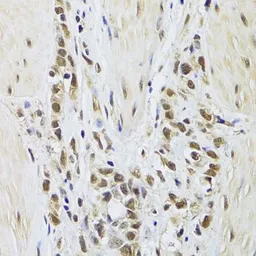 Anti-Splicing Factor 1 antibody used in IHC (Paraffin sections) (IHC-P). GTX54670
