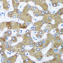 Anti-PTPIP51 antibody used in IHC (Paraffin sections) (IHC-P). GTX54674