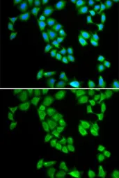 Anti-RNase 13 antibody used in Immunocytochemistry/ Immunofluorescence (ICC/IF). GTX54675