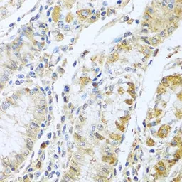 Anti-RNase 13 antibody used in IHC (Paraffin sections) (IHC-P). GTX54675